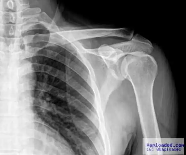 Shocking! Man Steals Wedding Ring But Gets Himself into More Trouble after He Swallows it to Avoid Arrest